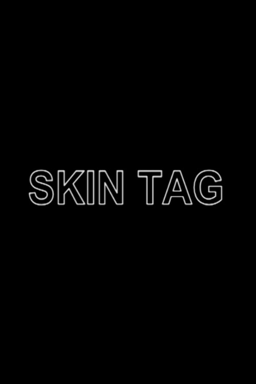 Skin Tag