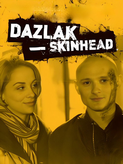 Dazlak – Skinhead